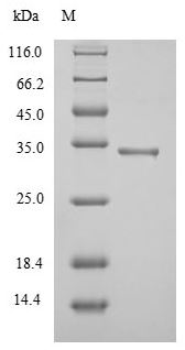 Discontinuous SDS-PAGE (reduced) with 5% enrichment gel and 15% separation gel.